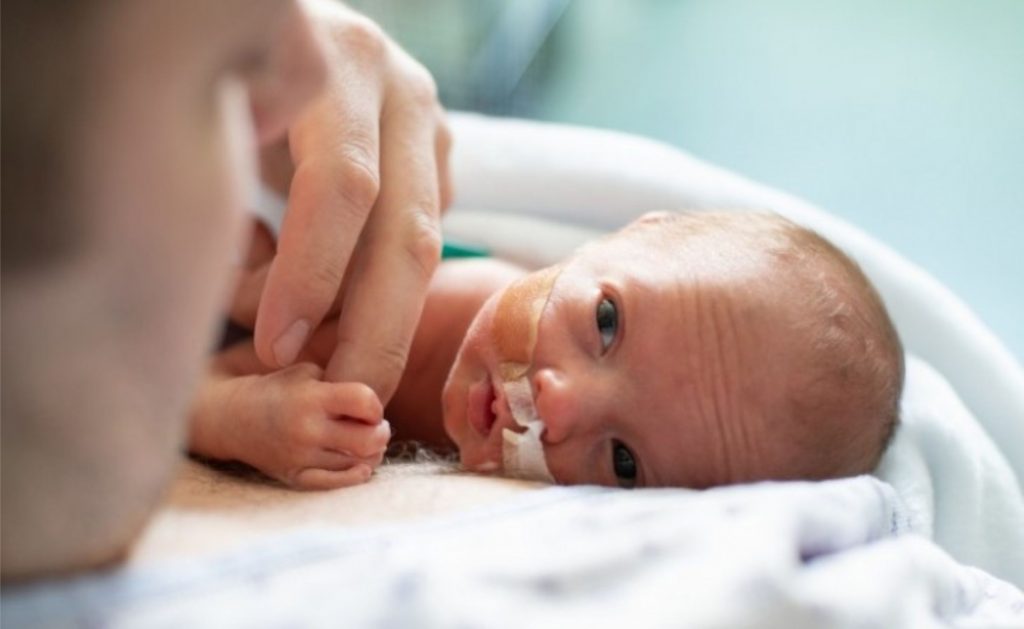 Abbott. A ECN afeta quase exclusivamente bebês nascidos prematuramente e pode ser fatal. Imagem: Getty/manonallard